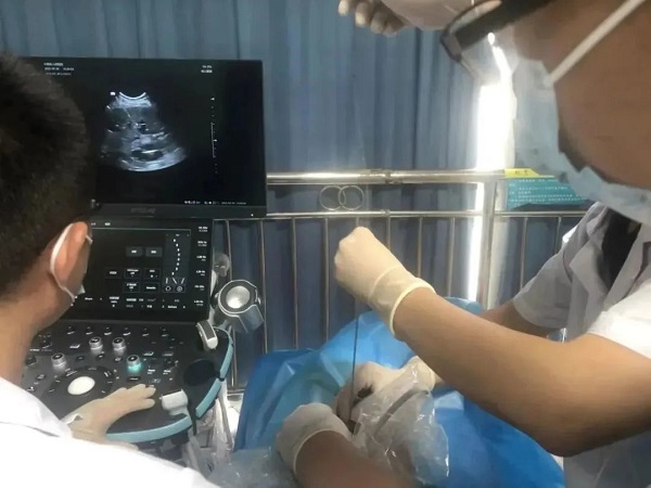 70歲老人因膽總管惡性腫瘤致阻塞性黃疸，PTCD術成功解決難題